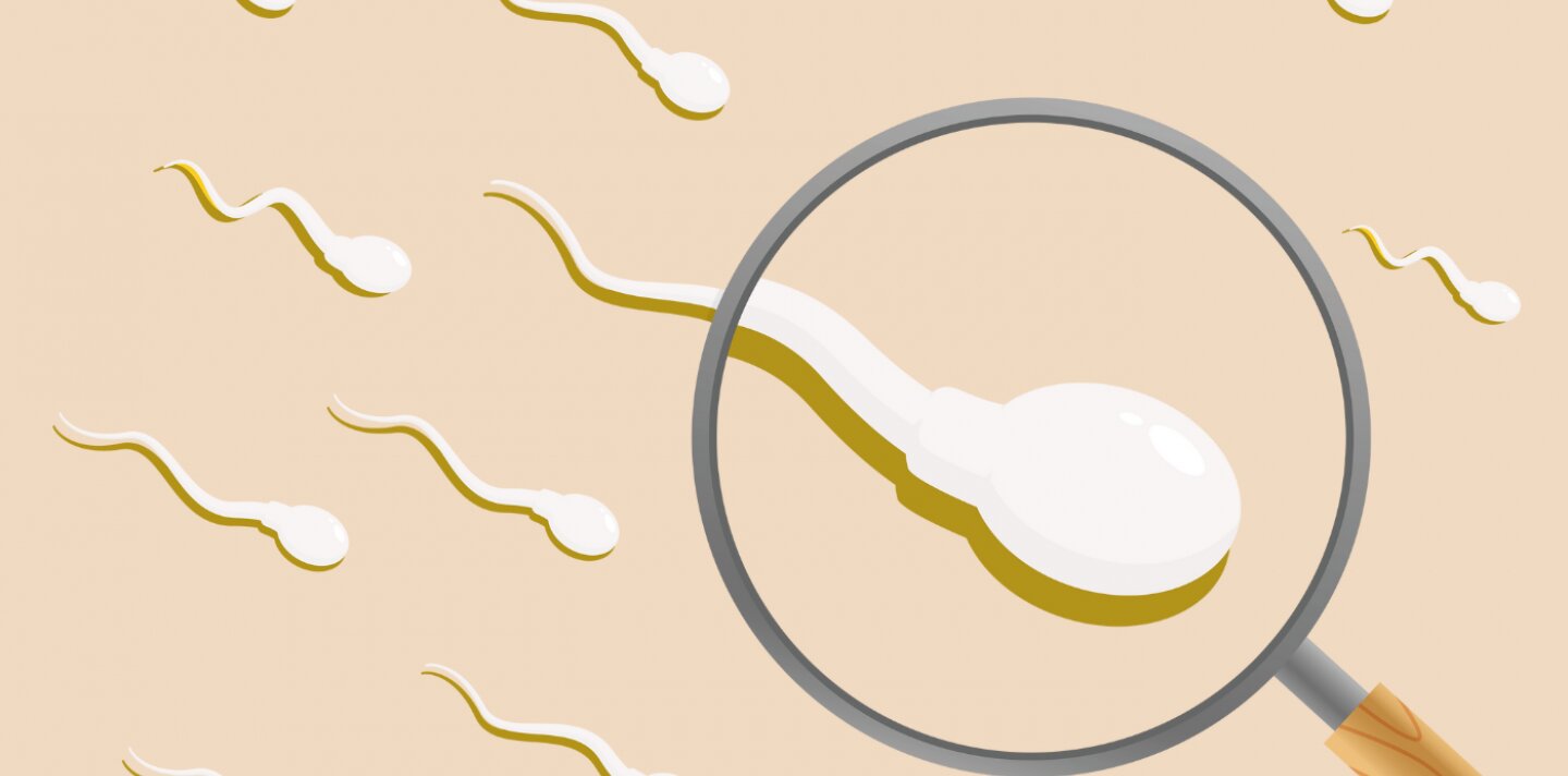Grafik von schwimmenden Spermien
